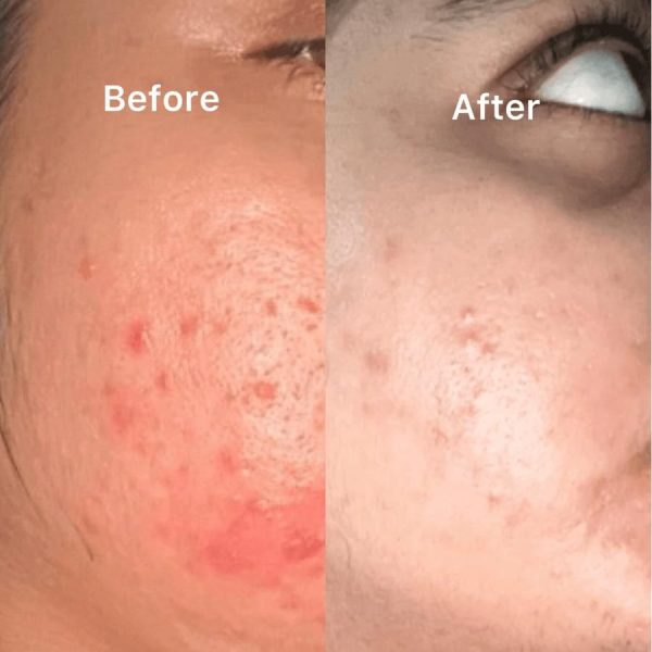 Nirvana Botanics Vitamin C+E Serum (15ml)