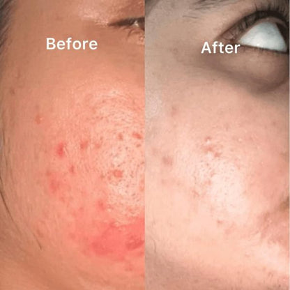 Nirvana Botanics Vitamin C+E Serum (15ml)
